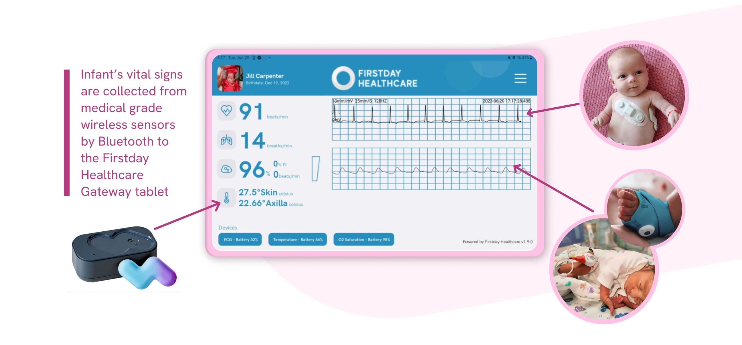 Vital signs on the gateway tablet
